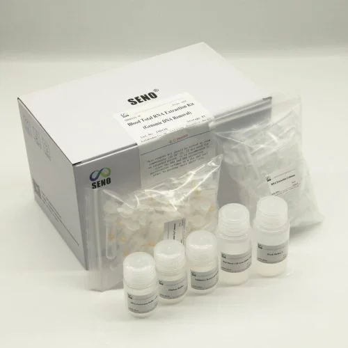 Blood Total RNA Extraction Kit (Genomic DNA Removal)