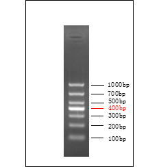 DL1000 DNA Marker