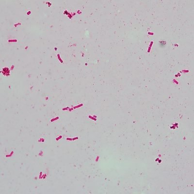 Flagella Stain Kit(Leifson)