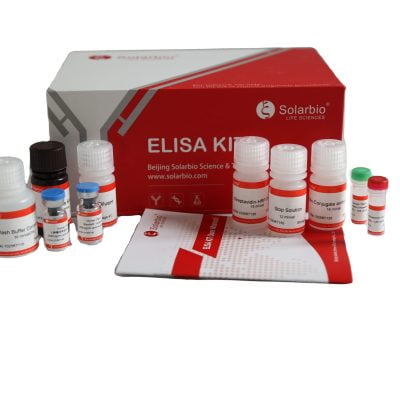 인간 sE-selectinCD62E Elisa 키트 (2)