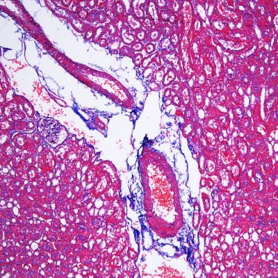 Masson's Trichrome Stain Kit