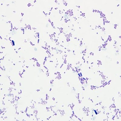 Weigert's Gram Stain Solution