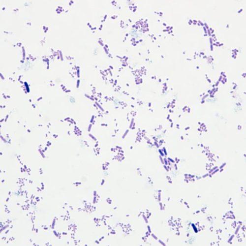 Weigert's Gram Stain Solution