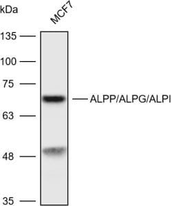 Western blot analysis with ALPPALPGALPI antibody diluted at 14000;LaneMCF7