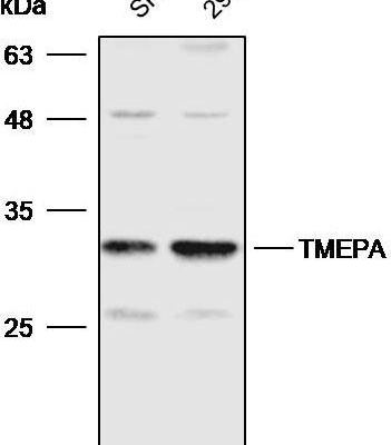 使用稀釋後的 TMEPA 抗體進行蛋白質印跡分析 1:2000;車道: SKOV3,293T