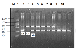 Restriction Fragment Length Polymorphism (RFLP) Experiment Procedure